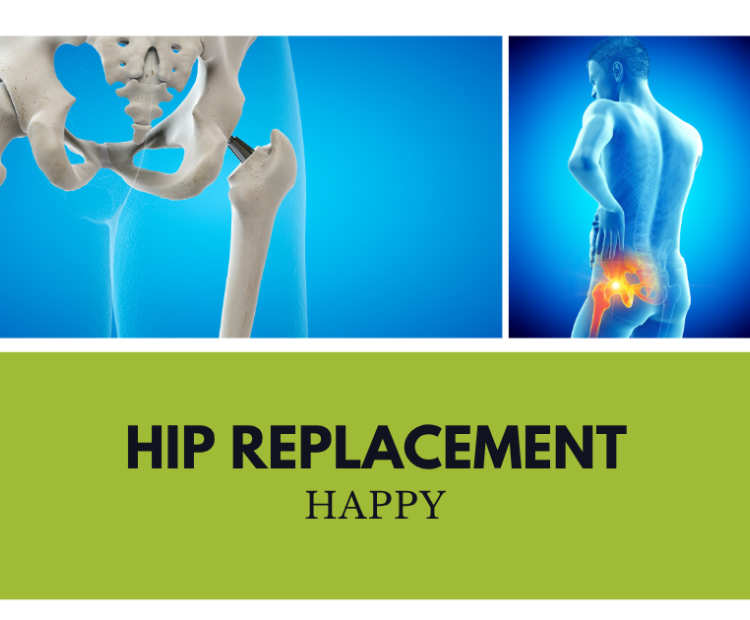 hip replacement