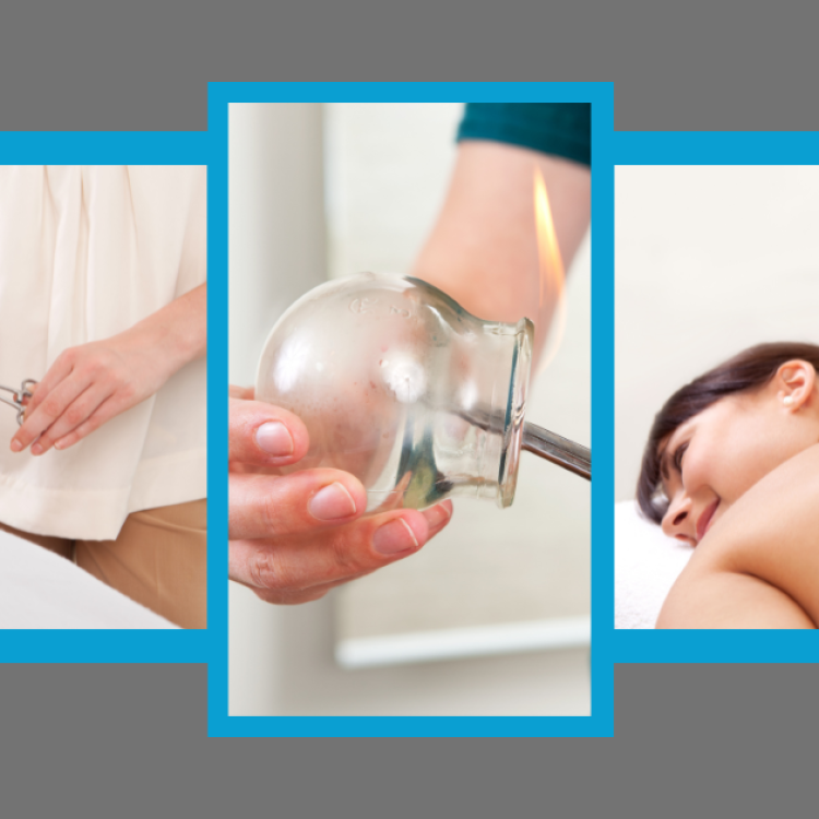 Fire Cupping at The Therapy Venue