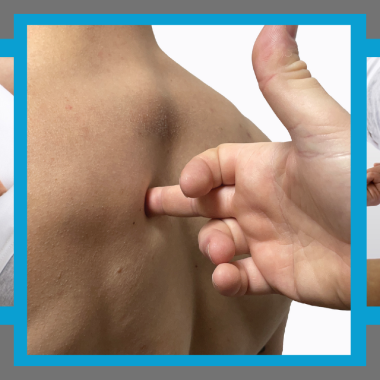 The EMMETT Technique at The Therapy Venue